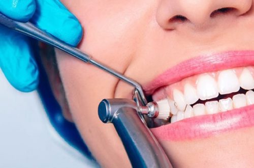 Профессиональная чистка зубов: ваш гид