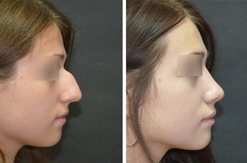 Пластическая хирургия