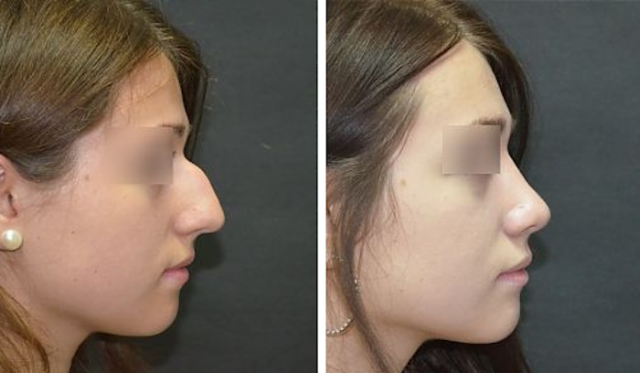 Пластическая хирургия