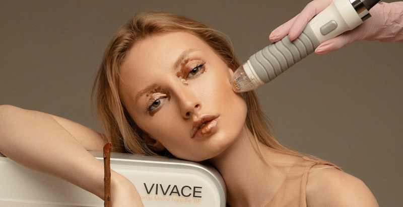 Микроигольчатый RF-лифтинг Vivace